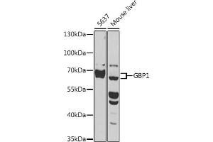 Western blot analysis of extracts of various cell lines, using GBP1 antibody (ABIN1679963, ABIN3018227, ABIN3018228 and ABIN6220409) at 1:1000 dilution. (GBP1 anticorps  (AA 383-592))