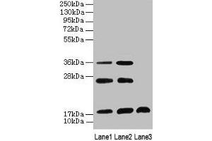 Western Blot All lanes: SFT2D2 antibody at 8 μg/mL Lane 1: Mouse liver tissue Lane 2: Mouse kidney tissue Lane 3: Mouse thymus tissue Secondary Goat polyclonal to rabbit IgG at 1/10000 dilution Predicted band size: 18 kDa Observed band size: 18, 26, 36 kDa (SFT2D2 anticorps  (AA 1-36))