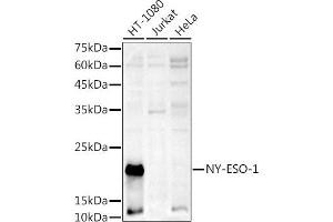 Western blot analysis of extracts of various cell lines, using NY-ESO-1 antibody (ABIN6129965, ABIN6139172, ABIN6139173 and ABIN6225112) at 1:1000 dilution. (CTAG1B anticorps  (AA 1-180))