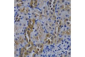 Immunohistochemistry of paraffin-embedded rat kidney using TNFRSF6B antibody (ABIN5970241) at dilution of 1/200 (40x lens). (TNFRSF6B anticorps)