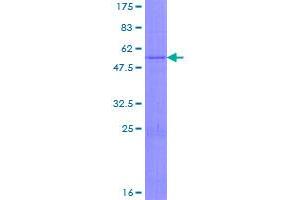 Image no. 1 for Kallikrein 14 (KLK14) (AA 1-251) protein (GST tag) (ABIN1308847)
