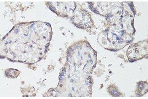 Immunohistochemistry of paraffin-embedded Human placenta using TrkB Polyclonal Antibody at dilution of 1:200 (40x lens). (TRKB anticorps)