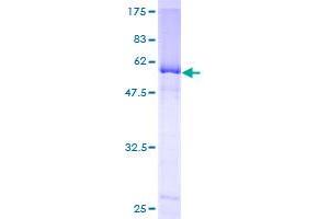 Image no. 1 for Endonuclease 8-like 2 (NEIL2) (AA 1-332) protein (GST tag) (ABIN1312344)