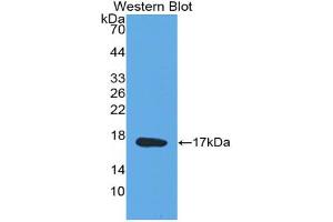 Western blot analysis of the recombinant protein. (Midkine anticorps  (AA 22-143))