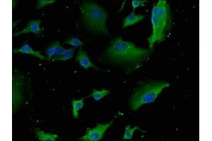 Immunofluorescence staining of U251 cells with ABIN7151082 at 1:133, counter-stained with DAPI.