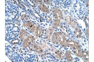 FBP1 antibody was used for immunohistochemistry at a concentration of 4-8 ug/ml. (FBP1 anticorps  (N-Term))