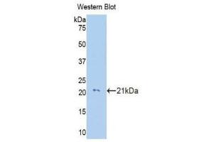 Western Blotting (WB) image for anti-Collagen, Type VIII, alpha 2 (COL8A2) (AA 533-698) antibody (ABIN1176005) (COL8a2 anticorps  (AA 533-698))