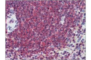 Human Spleen: Formalin-Fixed, Paraffin-Embedded (FFPE) (CA1 anticorps  (Internal Region))