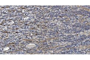 IHC analysis of Alpha B Crystallin/CRYAB using anti-Alpha B Crystallin/CRYAB antibody (ABIN7601209). (CRYAB anticorps  (AA 30-151))