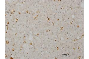 Immunoperoxidase of monoclonal antibody to SMG1 on formalin-fixed paraffin-embedded human adrenal gland.