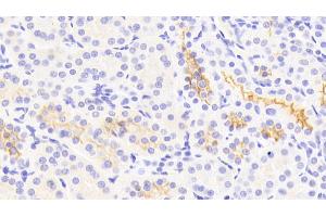 Detection of Kim1 in Human Kidney Tissue using Polyclonal Antibody to Kidney Injury Molecule 1 (Kim1)