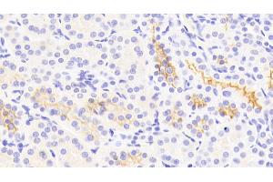 Detection of Kim1 in Human Kidney Tissue using Polyclonal Antibody to Kidney Injury Molecule 1 (Kim1) (HAVCR1 anticorps  (AA 21-240))