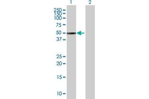 Western Blot analysis of ZNF643 expression in transfected 293T cell line by ZNF643 MaxPab polyclonal antibody. (ZNF643 anticorps  (AA 1-432))