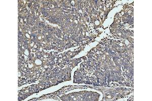 IHC analysis of MEK3 using anti-MEK3 antibody (ABIN3043874). (MAP2K3 anticorps  (C-Term))