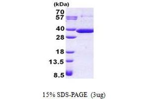 SDS-PAGE (SDS) image for Retinoic Acid Receptor Responder (Tazarotene Induced) 1 (RARRES1) (AA 43-294) protein (His tag) (ABIN5853032)