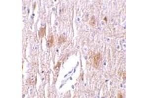 Immunohistochemistry of TRIM5 delta in mouse brain tissue with this product at 1 μg/ml. (TRIM5 anticorps  (C-Term, Isoform delta))