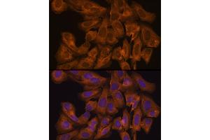 Immunofluorescence analysis of U-2 OS cells using J Rabbit pAb (ABIN7268038) at dilution of 1:100 (40x lens). (JAK1 anticorps  (AA 120-380))