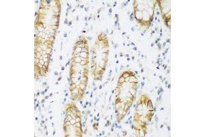 Immunohistochemistry of paraffin-embedded human stomach using KIAA1456 antibody at dilution of 1:200 (40x lens). (KIAA1456 anticorps)