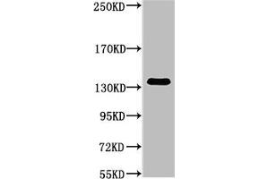 Western blot analysis of Hela, diluted at 1:1000. (COL3A1 anticorps)