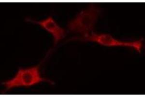 ABIN6275358 staining 293 cells by IF/ICC. (PIGX anticorps  (Internal Region))