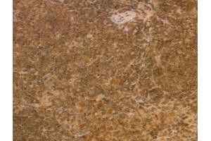 ABIN6257590 and ABIN6274935 at 1/100 staining Mouse spleen tissue by IHC-P.