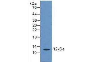 Western blot analysis of Human Liver Tissue. (CRADD anticorps  (AA 1-199))
