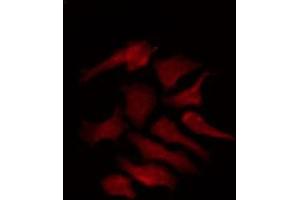 ABIN6275388 staining HepG2 by IF/ICC.