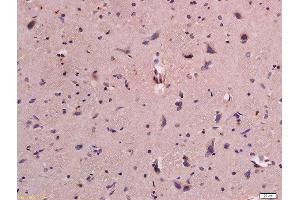 Formalin-fixed and paraffin embedded rat brain labeled with Anti-CD31 Polyclonal Antibody, Unconjugated  at 1:300 followed by conjugation to the secondary antibody and DAB staining. (CD31 anticorps  (AA 601-680))