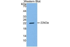 Western Blotting (WB) image for anti-CD8b Molecule (CD8B) (AA 22-175) antibody (ABIN1858319) (CD8B anticorps  (AA 22-175))