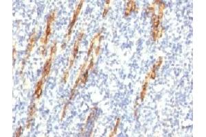 Formalin-fixed, paraffin-embedded human tonsil stained with CD34 antibody (QBEnd/10 + HPCA1/763)