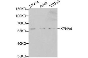 Western blot analysis of extracts of various cell lines, using KPNA4 antibody.