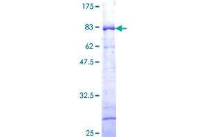 TTC4 Protein (AA 1-387) (GST tag)