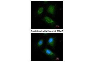 ICC/IF Image Immunofluorescence analysis of methanol-fixed HeLa, using ACADM, antibody at 1:100 dilution. (Medium-Chain Specific Acyl-CoA Dehydrogenase, Mitochondrial (N-Term) anticorps)