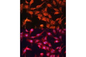 Immunofluorescence analysis of C6 cells using  antibody (ABIN6129849, ABIN6136345, ABIN6136346 and ABIN6217907) at dilution of 1:100.