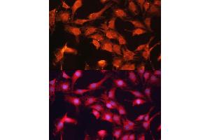 Immunofluorescence analysis of C6 cells using  antibody (ABIN6129849, ABIN6136345, ABIN6136346 and ABIN6217907) at dilution of 1:100. (ABCB10 anticorps  (AA 230-300))