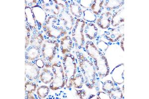 Immunohistochemistry of paraffin-embedded mouse kidney using Lumican (LUM) (LUM) Rabbit mAb (ABIN7268309) at dilution of 1:100 (40x lens).