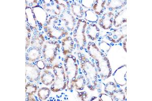 Immunohistochemistry of paraffin-embedded mouse kidney using Lumican (LUM) (LUM) Rabbit mAb (ABIN7268309) at dilution of 1:100 (40x lens). (LUM anticorps)
