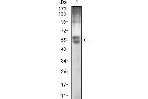 Western blot analysis using GPC3 mouse mAb against HEK293 (1) cell lysate. (Glypican 3 anticorps  (AA 359-554))