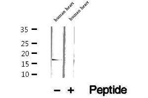 Western blot analysis of extracts of human heart tissue, using GMFG antibody.