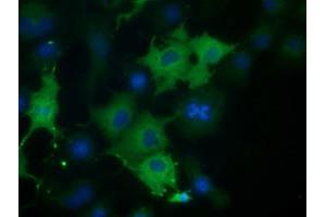 Anti-CORO1B mouse monoclonal antibody (ABIN2452912) immunofluorescent staining of COS7 cells transiently transfected by pCMV6-ENTRY CORO1B (RC203023). (CORO1B anticorps)
