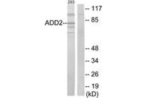 Western blot analysis of extracts from 293 cells, using ADD2 Antibody. (ADD2 anticorps  (AA 471-520))