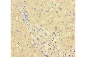 Immunohistochemistry of paraffin-embedded human liver tissue using ABIN7174872 at dilution of 1:100 (C6orf223 anticorps  (AA 9-89))