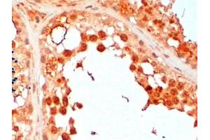 Immunohistochemistry (2μg/ml) staining of paraffin embedded Human Testis. (UBE2R2 anticorps  (N-Term))