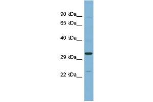 WB Suggested Anti-SET Antibody Titration: 0. (SET/TAF-I anticorps  (N-Term))