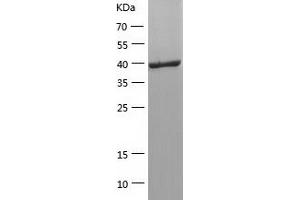 Selenoprotein P (SELENOP) (AA 20-381) protein (His tag)