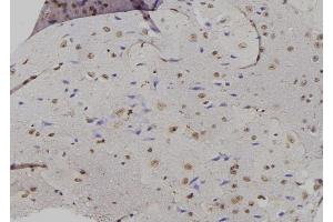 ABIN6261869 and ABIN6276885 at 1/100 staining Mouse brain tissue by IHC-P. (GADD45A anticorps  (N-Term))