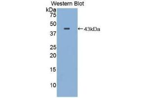 WB of Protein Standard: different control antibodies against Highly purified E. (Major Basic Protein Kit ELISA)