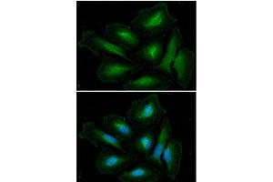 ICC/IF analysis of GLUL in HeLa cells. (GLN1 anticorps  (AA 1-373))