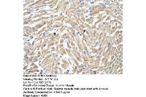 Rabbit Anti-TPM1 Antibody  Paraffin Embedded Tissue: Human Muscle Cellular Data: Skeletal muscle cells Antibody Concentration: 4. (Tropomyosin anticorps  (N-Term))