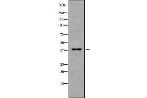 Western blot analysis of MARCH9 using MCF7 whole cell lysates (MARCH9 anticorps  (N-Term))